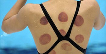 Is the Recovery Technique Beneficial?