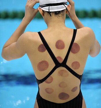 Is the Recovery Technique Beneficial?